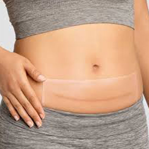 SILICONE SCAR PATCH